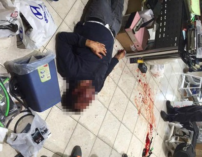 الزرقاء : ضرب عامل مصري بسبب 2000 دينار وحالته حرجه… التفاصيل