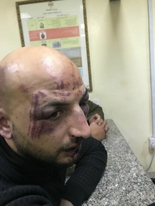 بالصورة …عضو مجلس امانة عمان الربيحات يروي تفاصيل الإعتداء عليه وعلى زميله السعود
