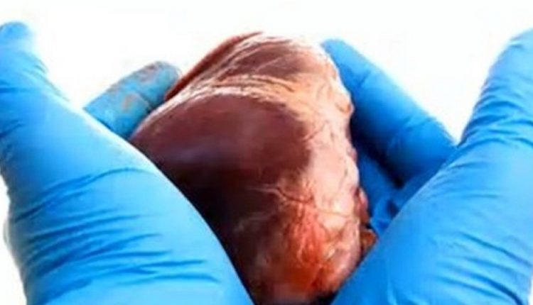 بالصور… 6 علامات “غير عادية” تشير إلى أنك قد تكون مريض قلب علوم