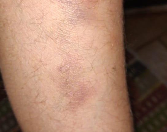 شاهد بالصور .. ولي أمر يبتز معلمين بتقرير طبي كاذب في عمان