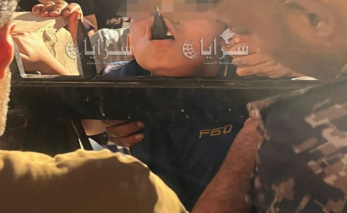 “سيخ حديد” يخترق عنق طفل ويخرج من فمه في محافظة الزرقاء