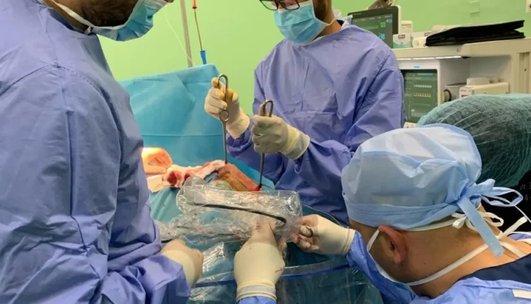 الأردن.. لأول مرة نجاح عملية لجراحة المنظار بتصحيح تشوهات جمجمة الأطفال بالبشير