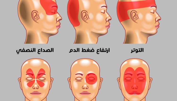 الصداع من أكثر الشكاوى شيوعًا التي يعاني منها الناس في مختلف الأعمار، ولكنه يختلف في أنواعه وأعراضه،