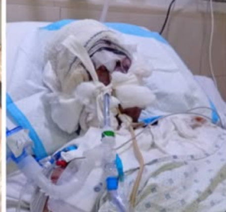 شاب يقدم على رمى زوجته بالزيت المغلي .. بسوريا