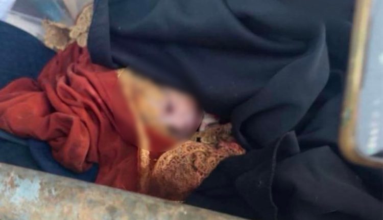 العثور على رضيع حديث الولادة داخل حاوية نفايات في الكرك